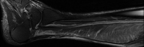 GHs MRI